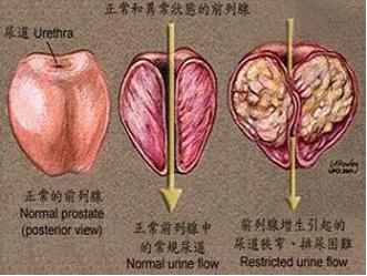 ԼǰƶǮ?